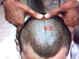 百會穴.JPG