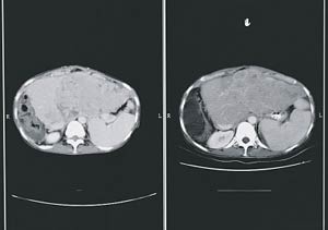 96031652rj2.jpg