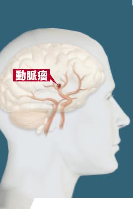 bn01.JPG