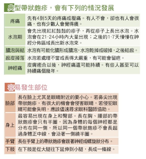 帶狀皰疹.jpg