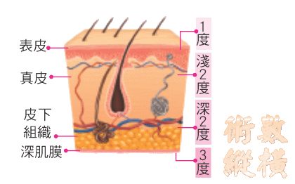 skin.gif