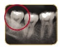 teeth02.jpg