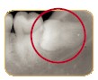 teeth05.jpg