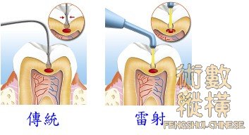 teeth12.jpg