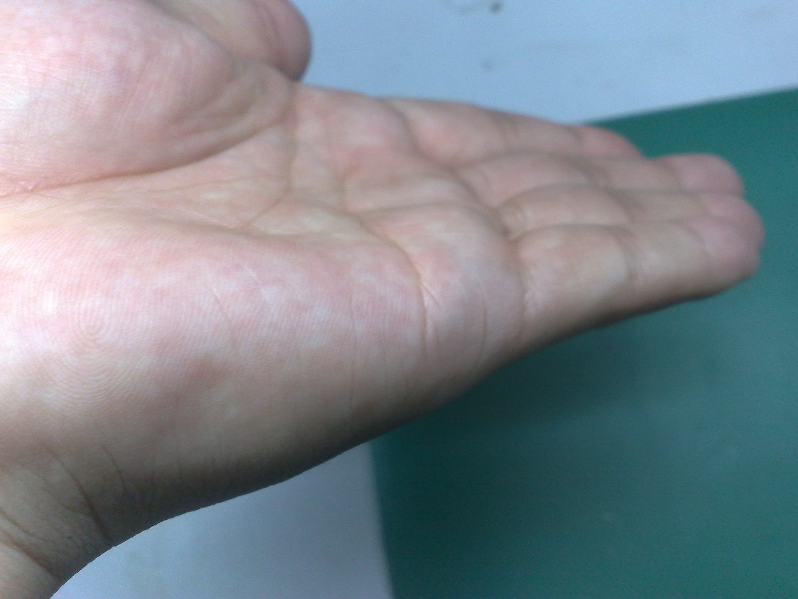 20100305135.jpg