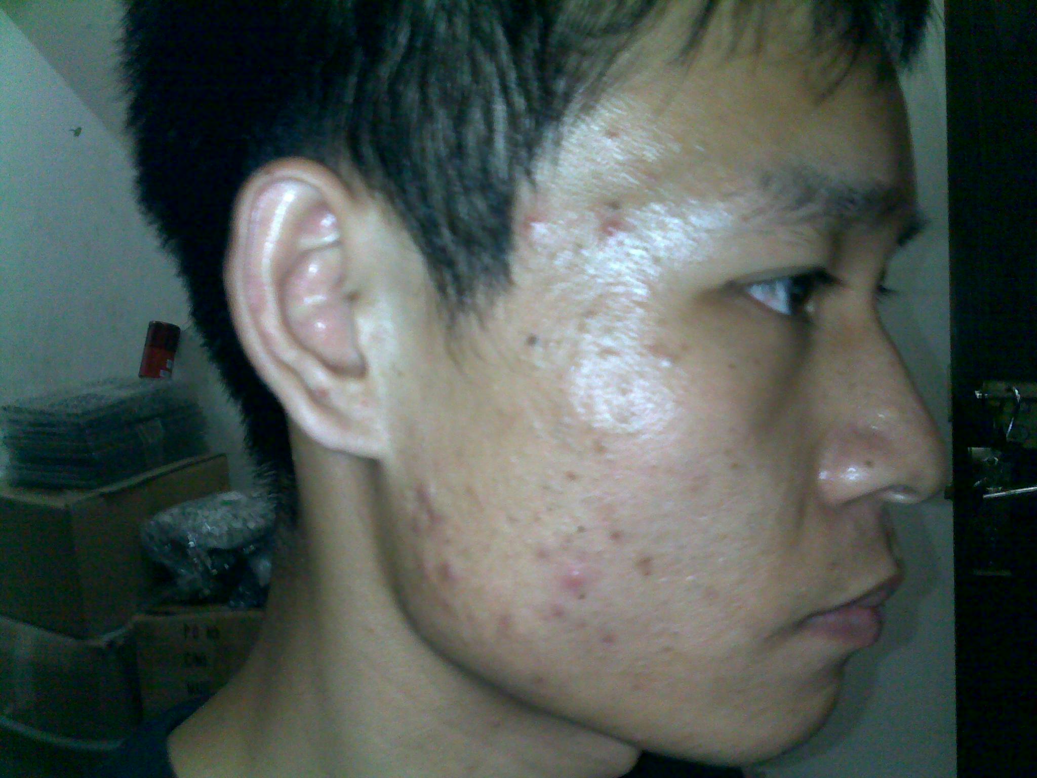 20110701300.jpg