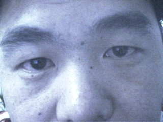 面2