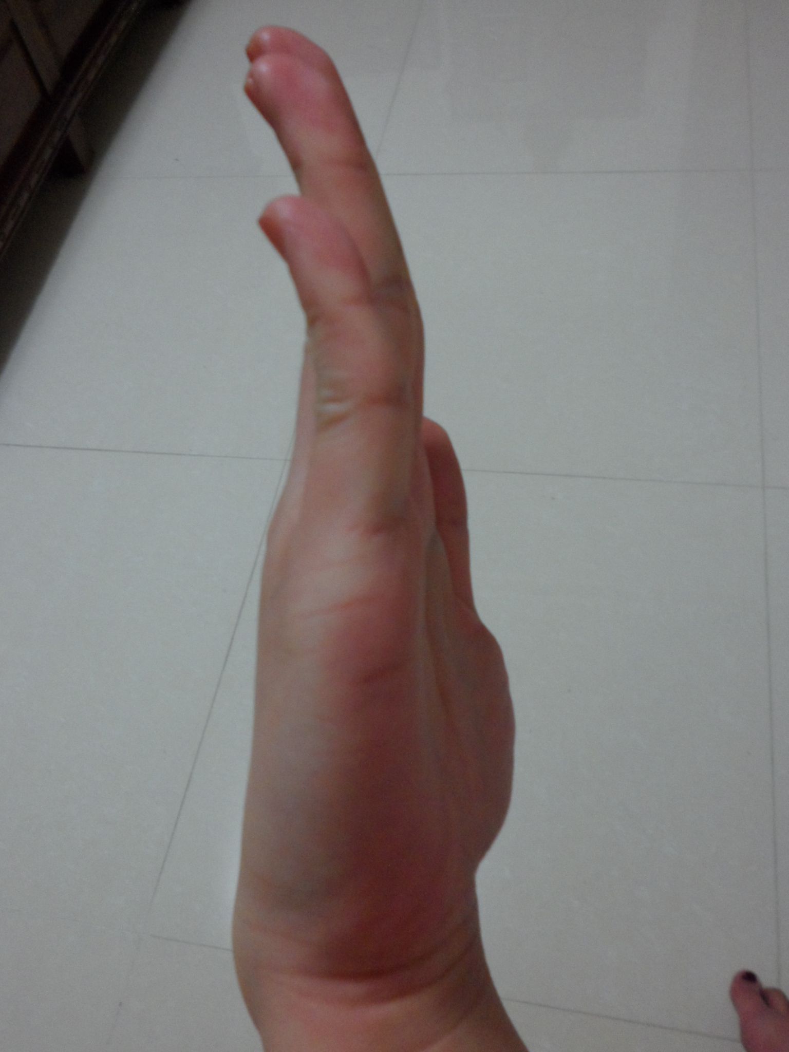 右４
