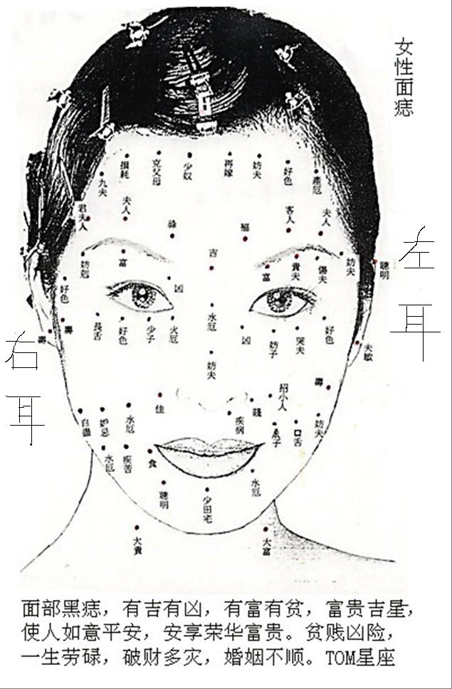 女-面痣圖.jpg