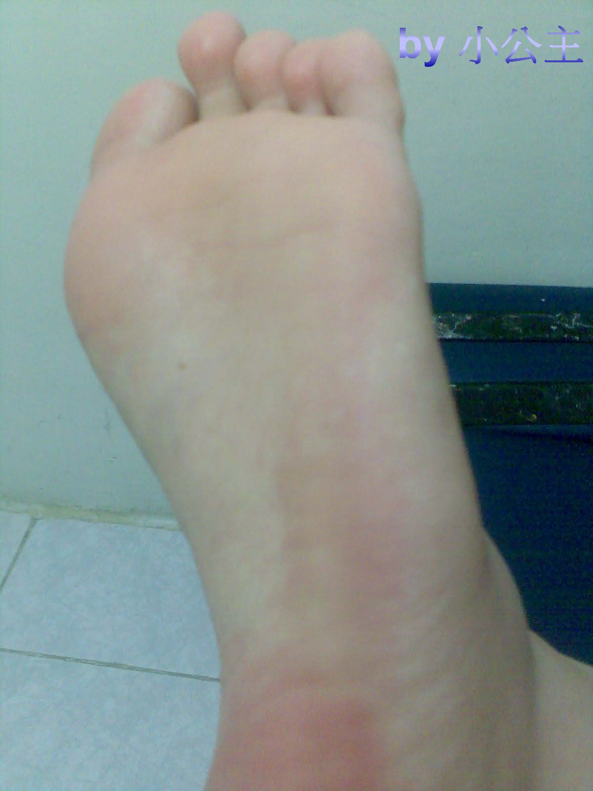 左腳腳板啡墨近鏡.jpg