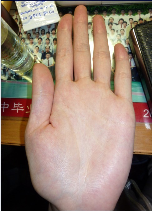 左手大圖