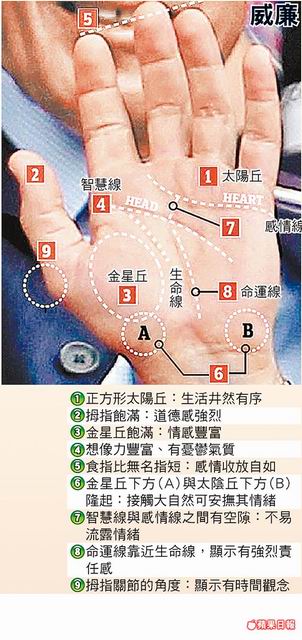 威廉手.jpg