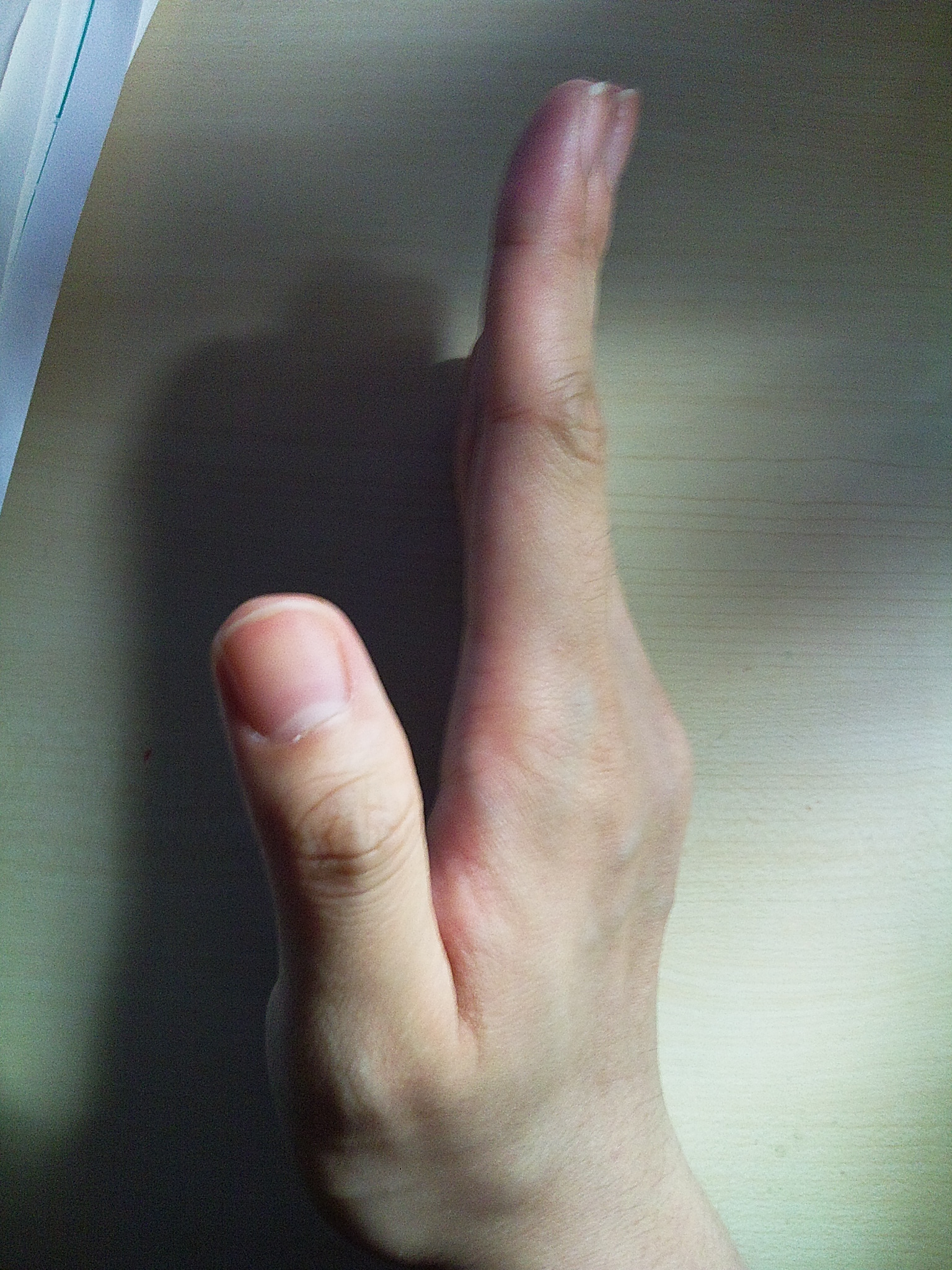 右掌側面一