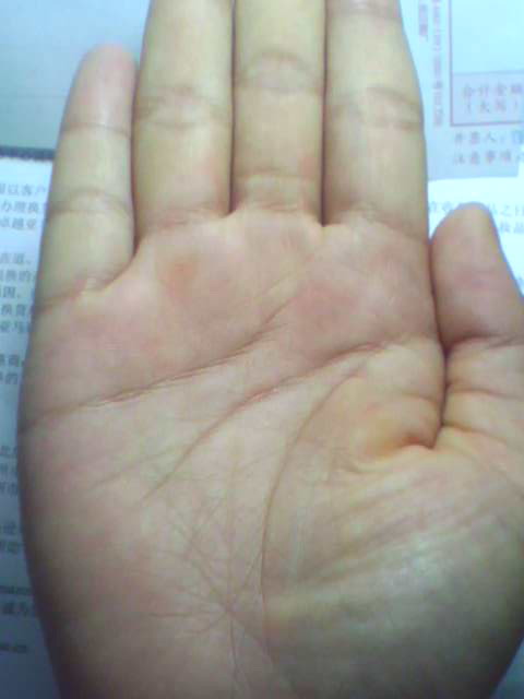 正面