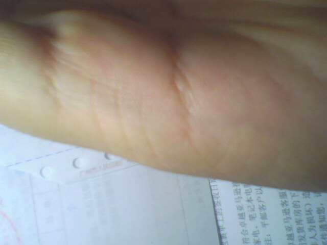侧面