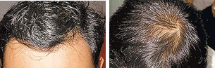 hair01.jpg